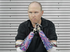 man with artificial arms leans on his elbows sitting at a table
